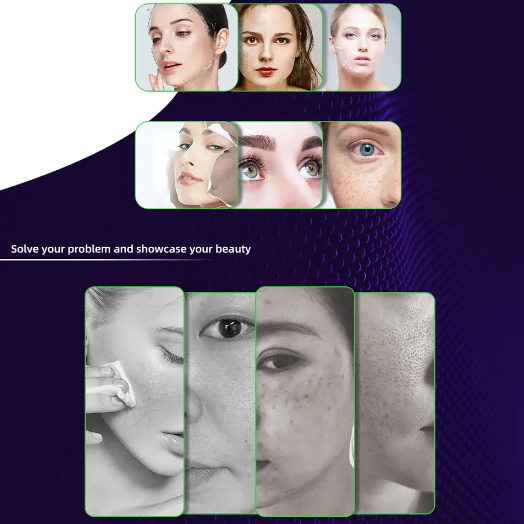 Nano Mesotherapy Microneedle Pen Meso Gun - Image 6
